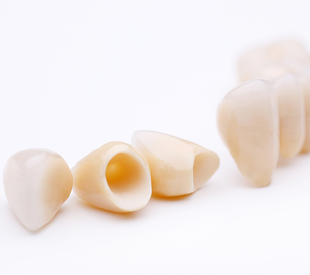 Canutillo Dental Crowns and Dental Bridges